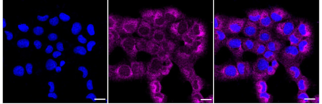 TAB3 Antibody in Immunocytochemistry (ICC/IF)