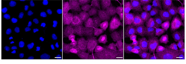 TBPL1 Antibody in Immunocytochemistry (ICC/IF)