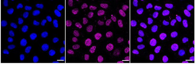 TBXA2R Antibody in Immunocytochemistry (ICC/IF)