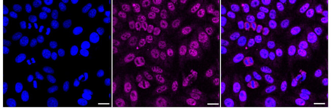 TIMM22 Antibody in Immunocytochemistry (ICC/IF)
