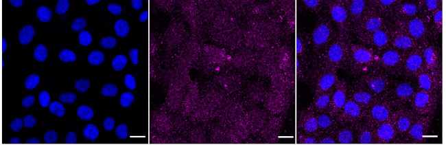 TRADD Antibody in Immunocytochemistry (ICC/IF)