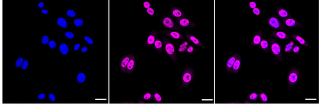 TRAM2 Antibody in Immunocytochemistry (ICC/IF)