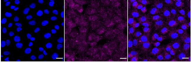 TCF21 Antibody in Immunocytochemistry (ICC/IF)