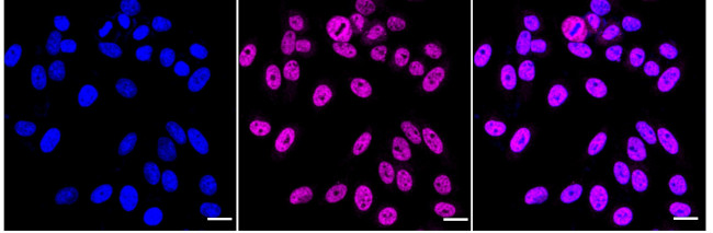 TRPC1 Antibody in Immunocytochemistry (ICC/IF)