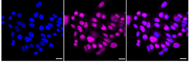 TRPV5 Antibody in Immunocytochemistry (ICC/IF)