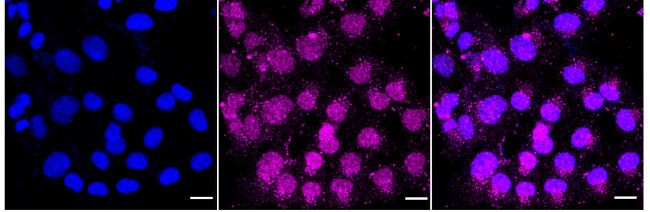 TUB Antibody in Immunocytochemistry (ICC/IF)