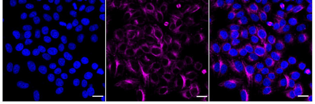 TUBA1B/TUBA4A Antibody in Immunocytochemistry (ICC/IF)