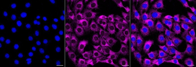 UBA52 Antibody in Immunocytochemistry (ICC/IF)