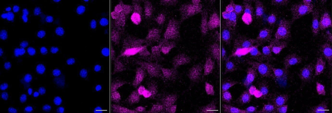 UBE2D1 Antibody in Immunocytochemistry (ICC/IF)