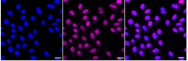 RAP80 Antibody in Immunocytochemistry (ICC/IF)