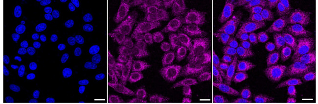 ULK1 Antibody in Immunocytochemistry (ICC/IF)