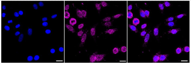 USF1 Antibody in Immunocytochemistry (ICC/IF)