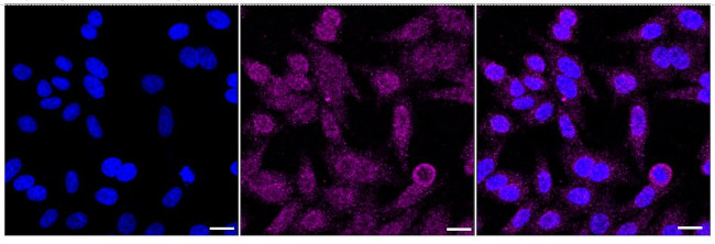 VAV1/2/3 Antibody in Immunocytochemistry (ICC/IF)