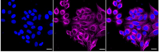 CHX10 Antibody in Immunocytochemistry (ICC/IF)