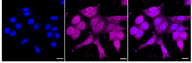 VPS11 Antibody in Immunocytochemistry (ICC/IF)