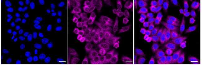 VPS18 Antibody in Immunocytochemistry (ICC/IF)