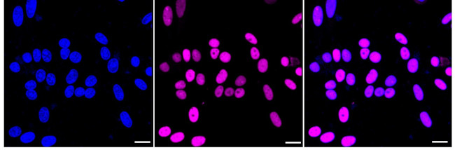 Pokemon Antibody in Immunocytochemistry (ICC/IF)