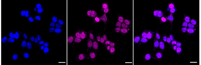 ZNF217 Antibody in Immunocytochemistry (ICC/IF)