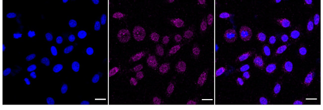 Placental Alkaline Phosphatase Antibody in Immunocytochemistry (ICC/IF)