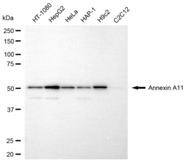 Annexin A11 Antibody in Western Blot (WB)