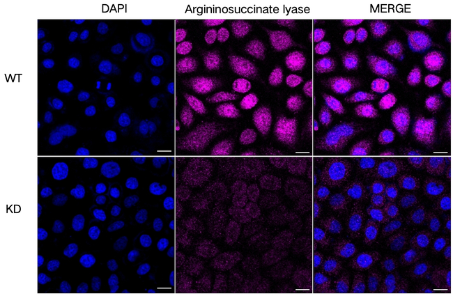 ASL Antibody in Immunocytochemistry (ICC/IF)