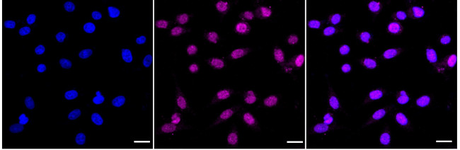 ATE1 Antibody in Immunocytochemistry (ICC/IF)