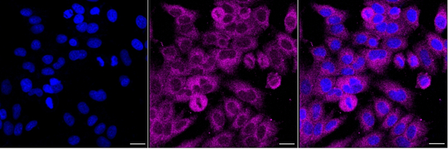 ASCC2 Antibody in Immunocytochemistry (ICC/IF)