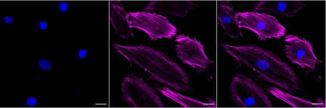Caldesmon Antibody in Immunocytochemistry (ICC/IF)