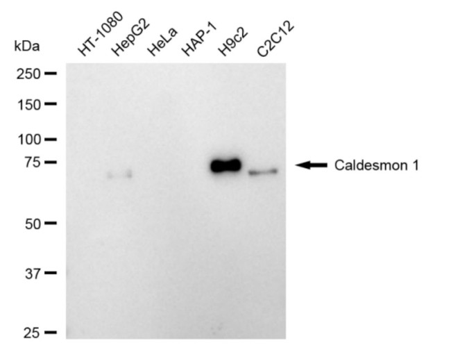 Caldesmon Antibody in Western Blot (WB)