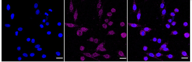 Caspase 8 Antibody in Immunocytochemistry (ICC/IF)