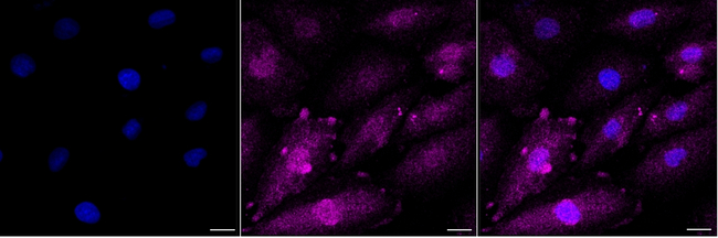 Catalase Antibody in Immunocytochemistry (ICC/IF)