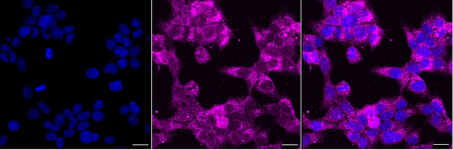 Catalase Antibody in Immunocytochemistry (ICC/IF)