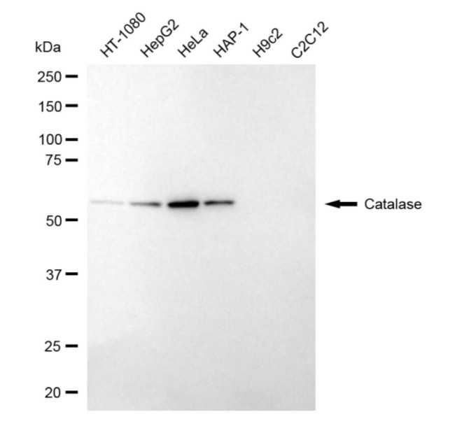 Catalase Antibody in Western Blot (WB)