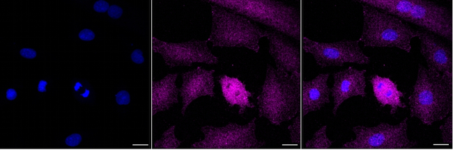 delta Catenin Antibody in Immunocytochemistry (ICC/IF)