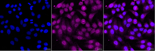 CDC123 Antibody in Immunocytochemistry (ICC/IF)