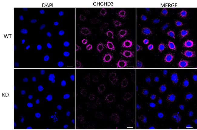 CHCHD3 Antibody in Immunocytochemistry (ICC/IF)