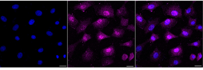 CRABP2 Antibody in Immunocytochemistry (ICC/IF)