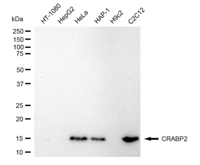CRABP2 Antibody in Western Blot (WB)