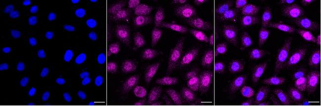 CDK2 Antibody in Immunocytochemistry (ICC/IF)