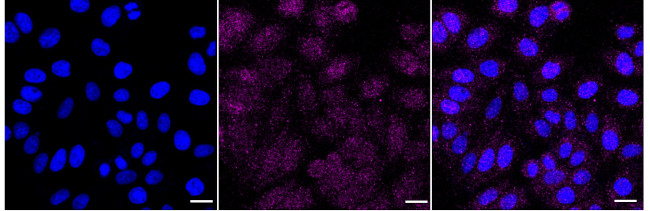 CDK4 Antibody in Immunocytochemistry (ICC/IF)