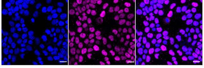 Cyclin E Antibody in Immunocytochemistry (ICC/IF)
