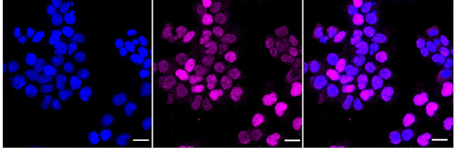 Cyclin E2 Antibody in Immunocytochemistry (ICC/IF)