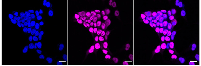 ICAD Antibody in Immunocytochemistry (ICC/IF)