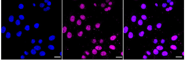 DNMT1 Antibody in Immunocytochemistry (ICC/IF)
