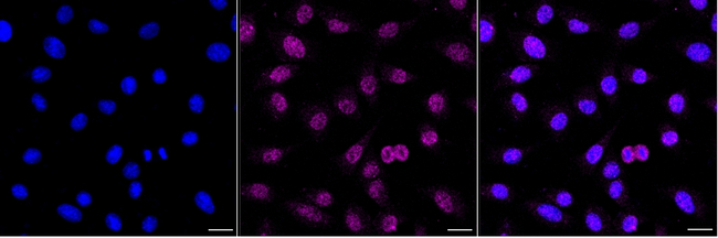 POLB Antibody in Immunocytochemistry (ICC/IF)
