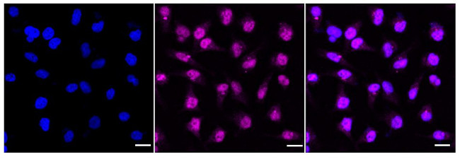 POLG Antibody in Immunocytochemistry (ICC/IF)