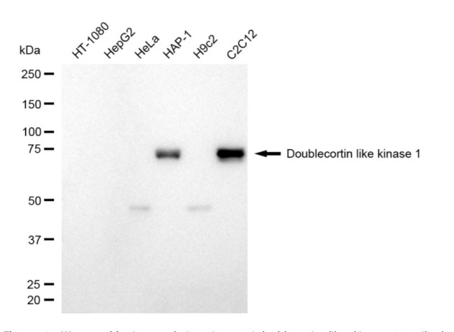 DCLK1 Antibody in Western Blot (WB)