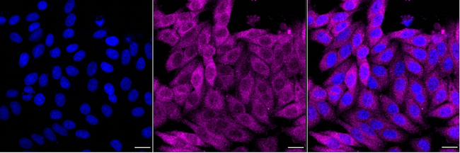 Destrin Antibody in Immunocytochemistry (ICC/IF)