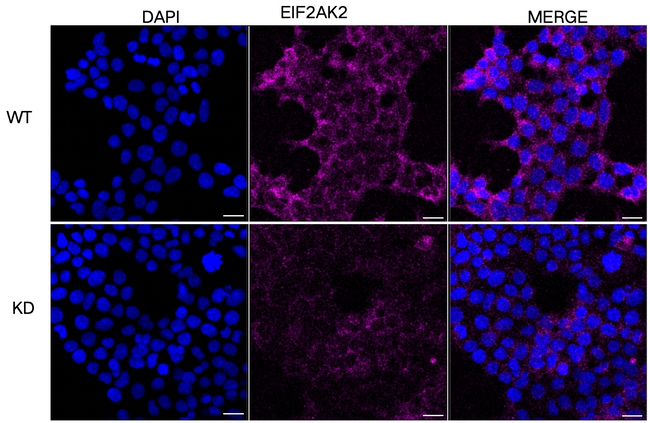 PKR Antibody in Immunocytochemistry (ICC/IF)