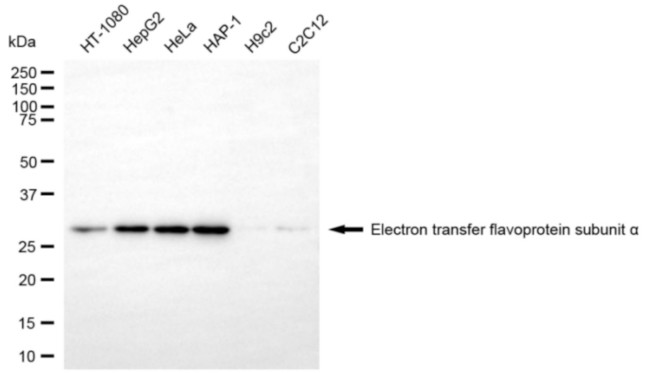 ETFA Antibody in Western Blot (WB)